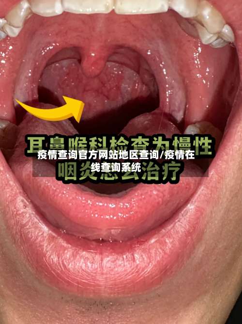 疫情查询官方网站地区查询/疫情在线查询系统-第2张图片